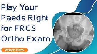 Play Your Paeds Right for FRCS Ortho  Exam | Orthopaedic Academy