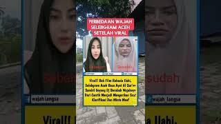 Perbedaan wajah selebgram Aceh setelah viral di sosmed‼️ #shorts #short #shortvideo