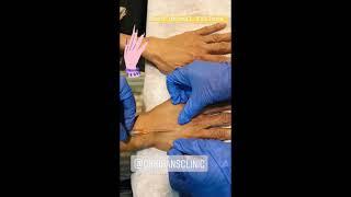 Wrinkle Treatment  at Kiran's clinic Mumbai | Best Dermatologist in Mumbai
