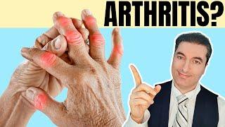 Eat This to Heal Rheumatoid Arthritis Without Medication