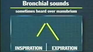 Звуки при аускультации легких breath Sounds mp4