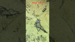 Nose rust under the microscope | TULO - Microscope #shorts #microscope #bacteria #nose