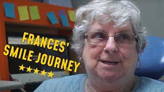 Frances' Dental House Experience | Dentures | Patient Testimonial  