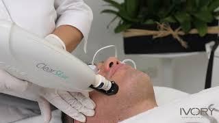 Clear Skin Laser Man - Ivory Aesthetics Dubai