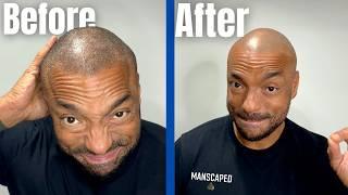 Why the Manscaped Dome Shaver Pro is a keeper!