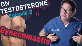 Gynecomastia - On Testosterone Ep 2