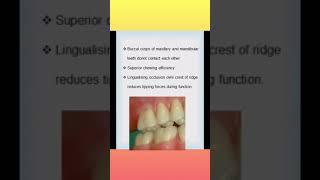 Prosthohub #lingualised occlusion #YouTube Shorts