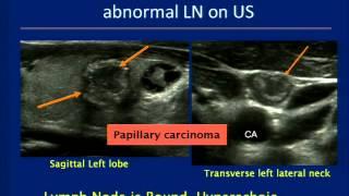 Thyroid Ultrasound Course