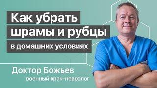 КАК УБРАТЬ ШРАМЫ и рубцы после операции в домашних условиях