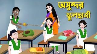 অসুন্দর স্কুলছাত্রী | Kalo Schoolchatri | Bengali Moral Stories Cartoon | Bangla Golpo | GolpoKonna