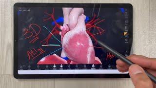 Complete Anatomy 2022 On Samsung Galaxy Tab S6 Lite - Anatomy 3D Atlas App Tutorial