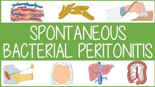 Spontaneous Bacterial Peritonitis Visually Explained