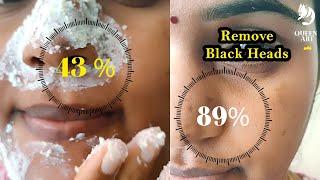 Remove black heads permanently at home in 7days | Fast result | Qat