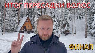 ИТОГ ДВУХ ПЕРЕСАДОК ВОЛОС. ФИНАЛЬНЫЙ ОТЧЕТ.