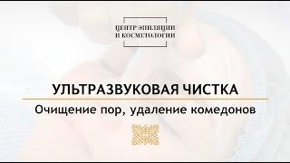 Ультразвуковая чистка. Центр эпиляции и косметологии Казань