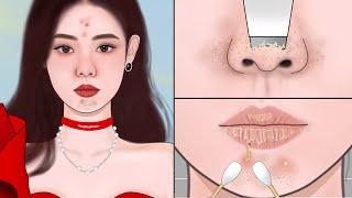 ASMR Satisfying Squeeze Pimples Animation! Does Makeup Make You Breakout? | Meng’s Stop Motion