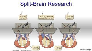 Split Brain Syndrome....Explained!