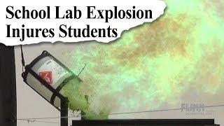 Common School Laboratory Accidents