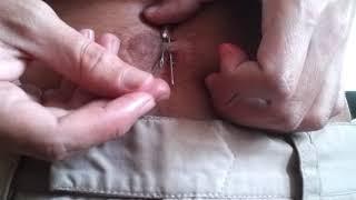 Needle in navel