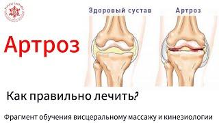 Артроз. Как правильно лечить? Фрагмент обучения висцеральному массажу и кинезиологии