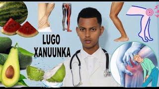 LUGO XANUUNKA IYO NAFAQAADKA U WANAAGSAN