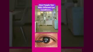 How People See With Different Eye Conditions: #diabetic retinopathy #glaucoma #cataract