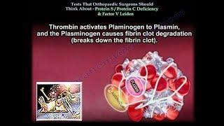 Protein S Protein C Factor V Leiden,Tests Ortho Surgeons Think About