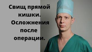 Свищ прямой кишки. Операция? Лазер? Осложнения после операции.