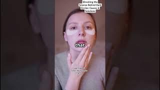 "Dark Circles Explained: Causes, Science & Natural Remedies | Biotic World"