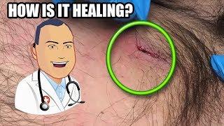 Manny's Follow Up, How is it Healing?  Dr. John Gilmore