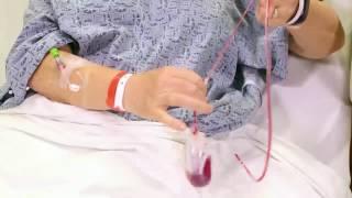 How to Care for Your Surgical Drain (at home)