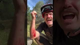 You Crashed? How’s the Bike!!  