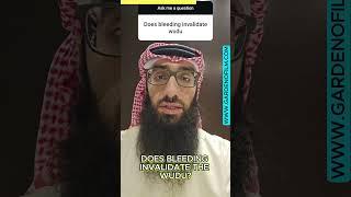 Does bleeding invalidate wudu? | Ustadh AbdulAziz Al-Haqqan حفظه الله