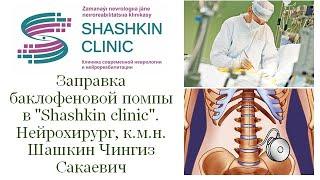 Заправка баклофеновой помпы в "Shashkin clinic". Нейрохирург Шашкин Чингиз Сакаевич