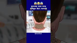 ঘুমানোর সময় ঘাড়ে উকুন উঠে গেলো #cartoon