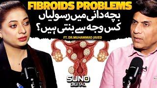 What Are Fibroids Treatment | Types, Causes and Symptoms  | Ft. Dr. Muhammad Javed