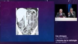 Histoire de la Radiologie - Conférence Antoine Béclècre - JFR 2015