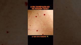 Красные точки причины и что делать?