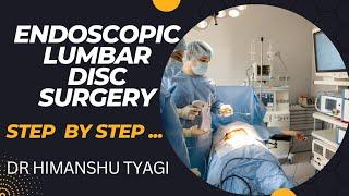 Endoscopic lumbar disc surgery (step by step). Dr Himanshu Tyagi