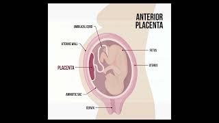 Anterior Placenta : common condition in pregnancy #healthcare #health #pregnancy