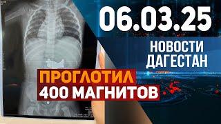 Ребенок проглотил около 400 магнитов. Новости Дагестана за 06.03.2025 год