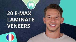 E-max Laminate Veneers in Turkey | Amazing Smile Transformation at Dentatur