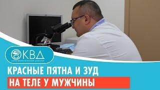  Красные пятна и зуд на теле у мужчины. Клинический случай №995