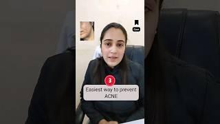 3 easy tips to prevent acne | pimple treatment by Dr Kratika Mohan #shorts #acnetreatment