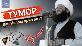 Оё Тумор дар Ислом ҷоиз аст ё не?