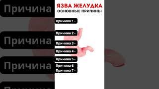 Как уберечь ЖЕЛУДОК от ЯЗВЕННОЙ БОЛЕЗНИ? #меднавигатор #язва #желудок