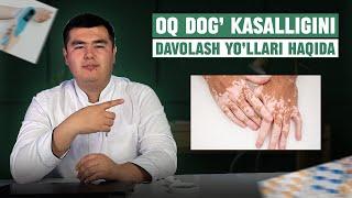 OQ DOG' KASALLIGINI DAVOLASH YO'LLARI | Kompleks davolash usuli