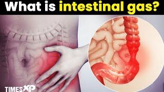 What Is Intestinal Gas, Gas Pain, Burping & Flatulence | Health Tips | TimesXP