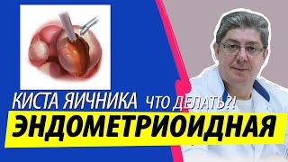 Выявлена ЭНДОМЕТРИОИДНАЯ киста яичника: инструкция что делать!