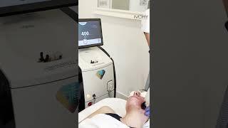 Clear Skin Er GLASS Acne Treatment - Ivory Aesthetics Clinic in Dubai